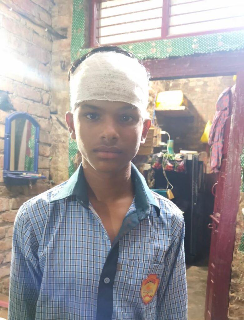 मोबाइल मांगने के बहाने किशोर पर धारदार हथियार से हमला, सिर में गंभीर चोट 3 131984